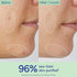Vinopure Pore Purifying Gel Cleanser